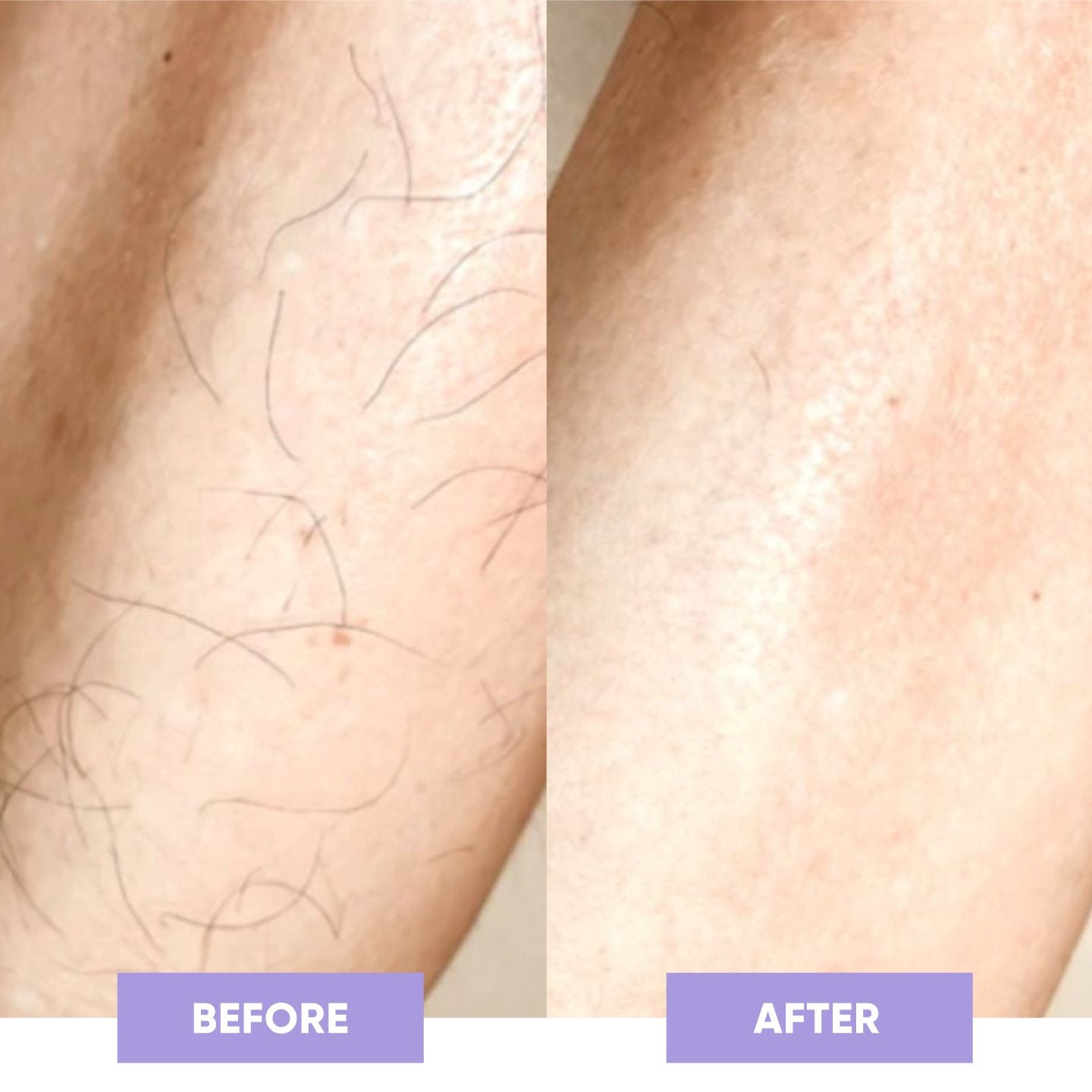 Velynia™ - Crystal Hair Eraser