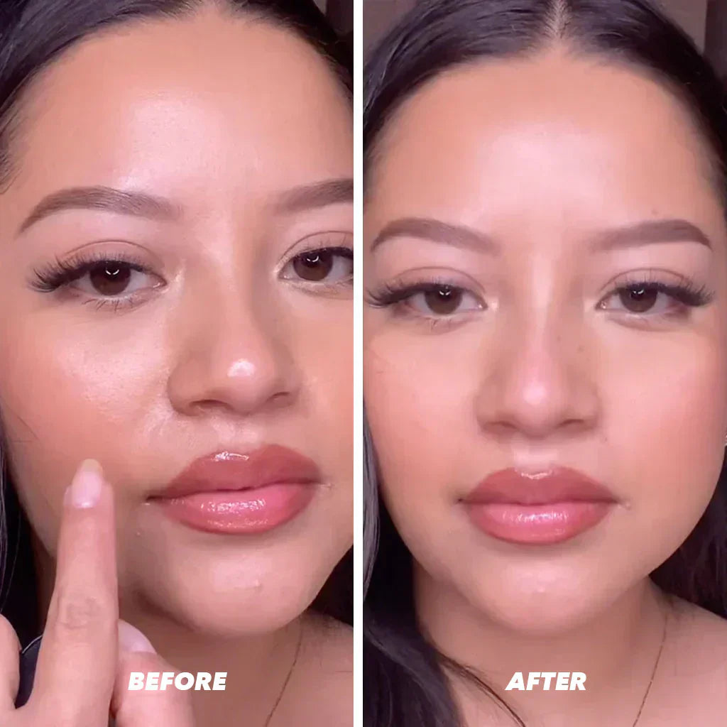 Velynia™ - Oil Absorbing Volcanic Roller