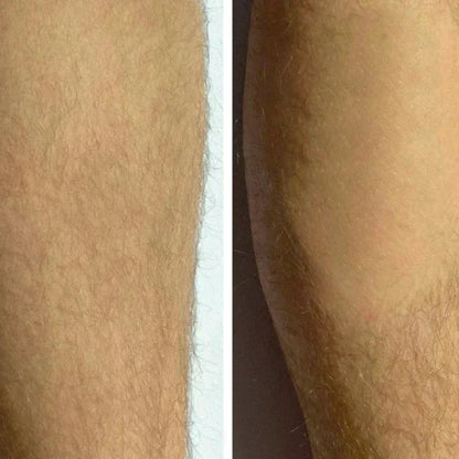 Velynia™ - Crystal Hair Eraser