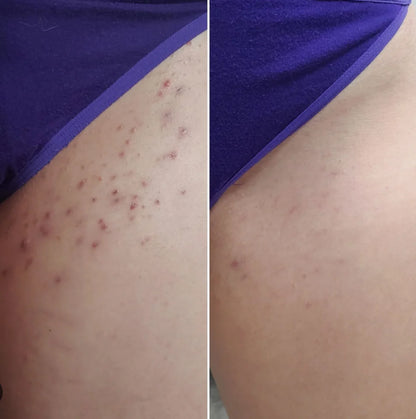 Velynia Ultimate 2-in-1 Bikini Trimmer